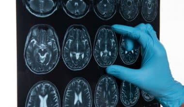 neurovascular assessment